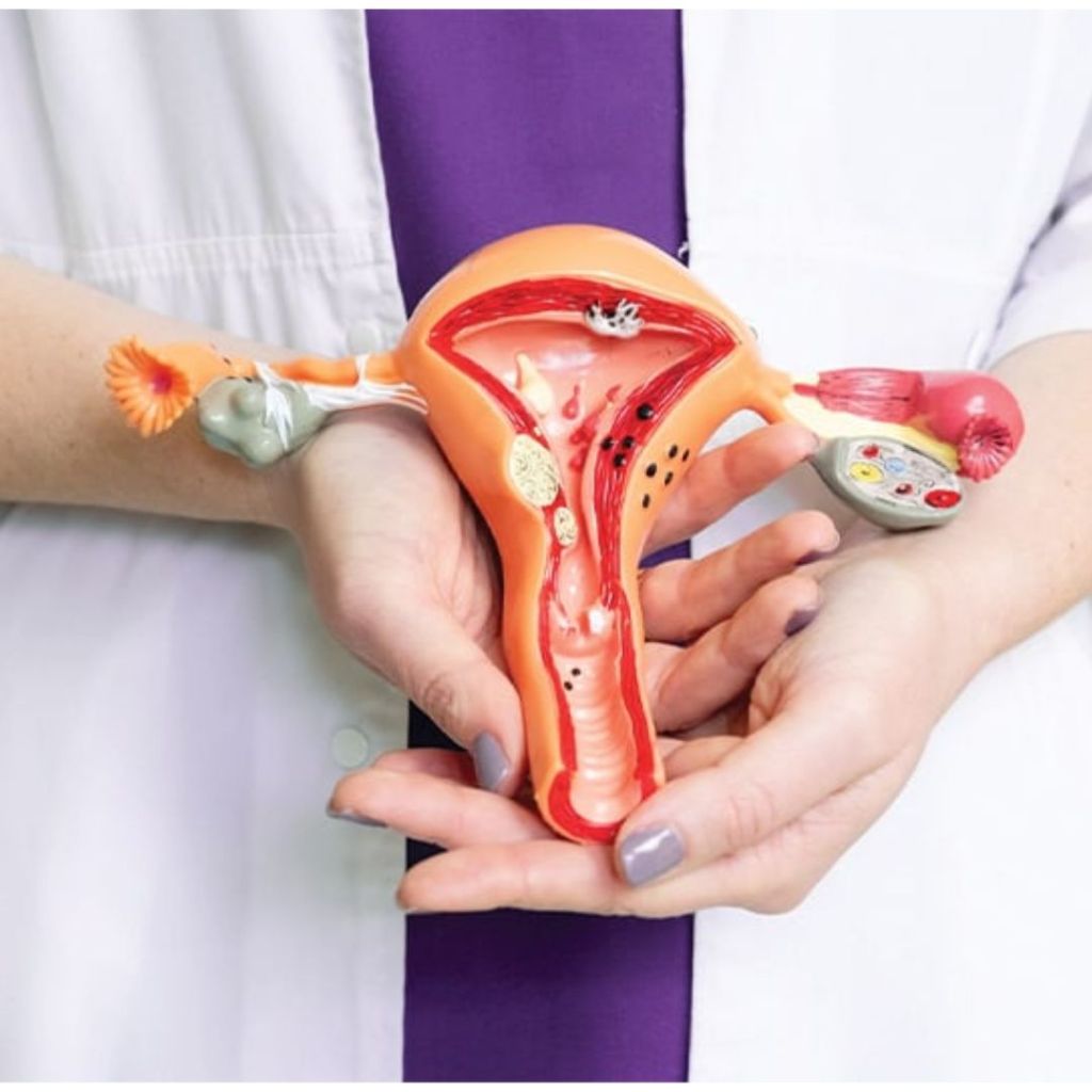  endometriosis treatment in delhi