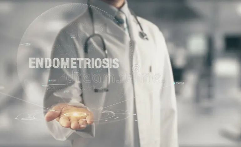 endometriosis treatment in Delhi