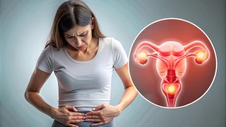 ayurvedic doctor for PCOS